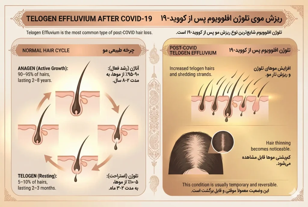 علت ریزش مو بعد از کرونا