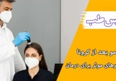 ریزش مو بعد از کرونا چیست؟